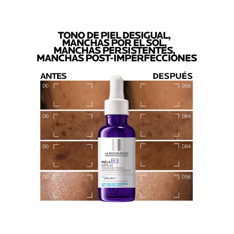D_NQ_NP_2X_825552-MLU76289372251_052024-F-1.webp Sérum Concentrado Mela B3 La Roche-Posay Antimanchas 30ml con Melasyl y 10% Niacinamida Previene la Reaparición