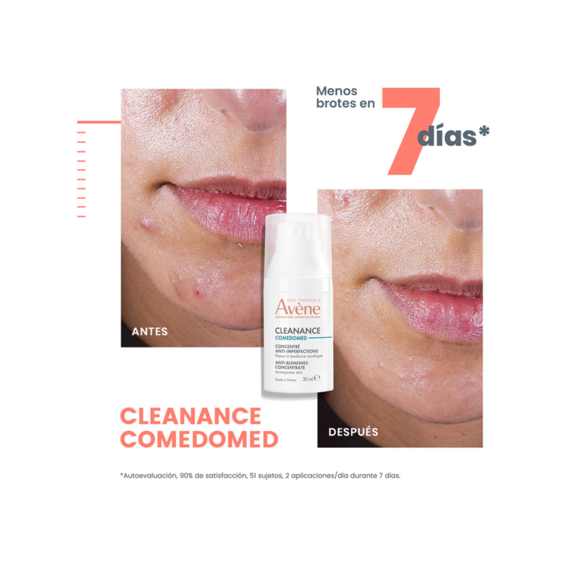 Avène Cleanance Comedomed Piel Grasa Antiimperfecciones 30ml